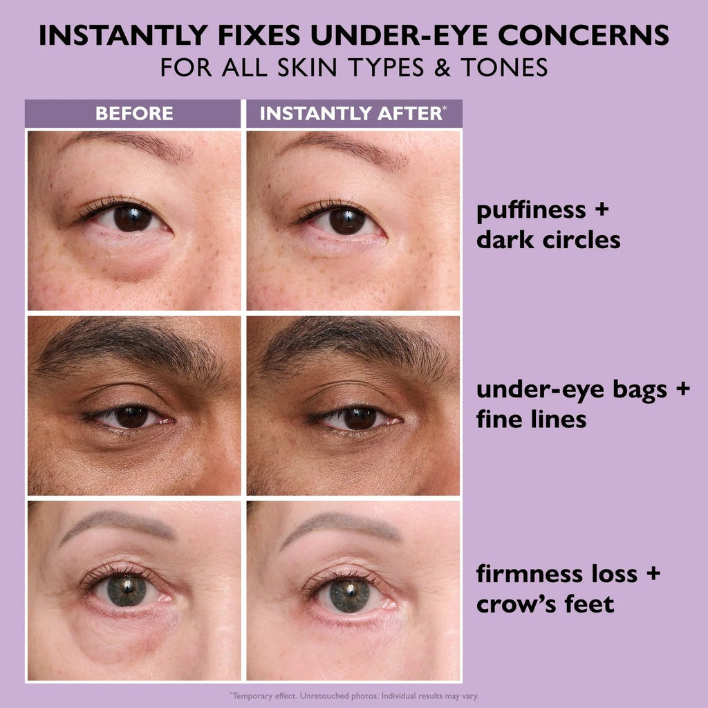 ✨ Instant Eye Tightener Primer – Firming Under Eye Serum with Hyaluronic Acid & Vitamin E